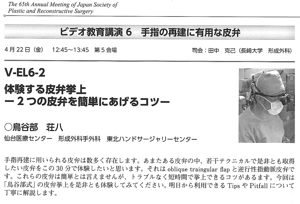 ビデオ教育講演６　手指の再建に有用な皮弁